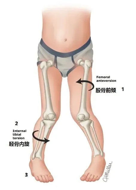 孩子不正确的坐姿有哪些危害