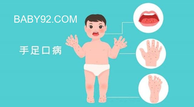 如何预防和护理儿童手足口病?-小儿手足口病预防和护理图片
